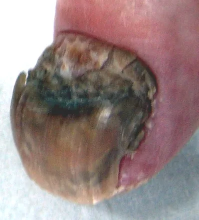 Vorher